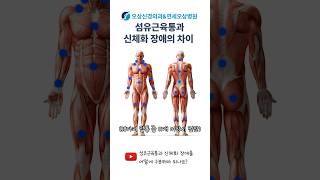 섬유근육통과 신체화 장애의 차이? #shorts