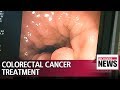 Precision medicine in colorectal cancer to provide personalized treatment