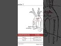 Stanford Type A vs Type B Aortic Dissection Explained