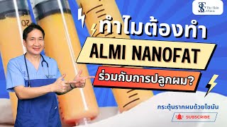 ทำไมต้องทำนาโนแฟต (ALMI Nanofat) ร่วมกับการปลูกผม?