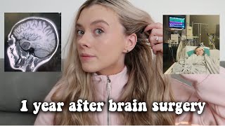 1 year after brain surgery | my brain cancer journey