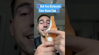 Did you dislocate your knee cap? (Find out why it keeps dislocating) #shorts