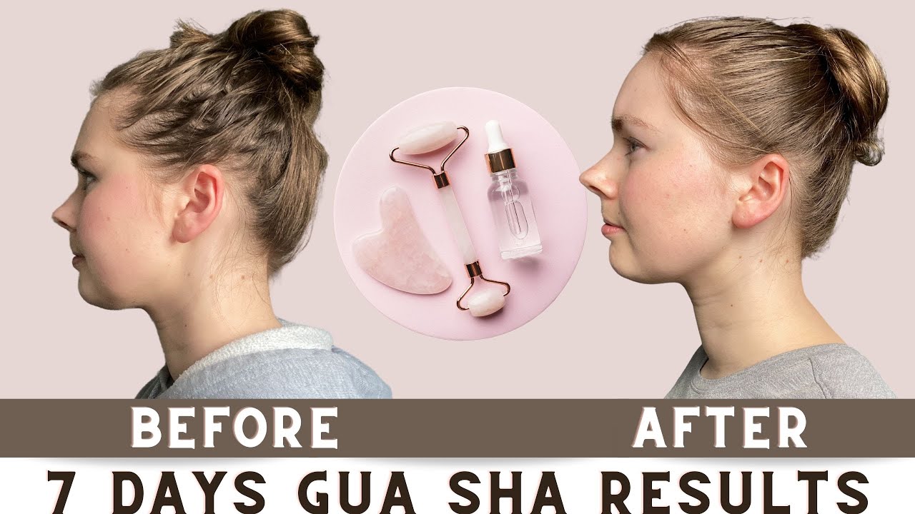 1 Week GUA SHA Results | Gua Sha Before And After Results | Gua Sha ...