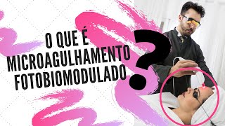 O QUE É ICROAGULHAMENTO FOTOBIOMODULADO? FUNCIONA?