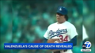 Dodger legend Fernando Valenzuela's cause of death revealed