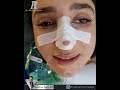 بلافاصله بعد از اتمام جراحی زیبایی بینی در اتاق ریکاوری immediately after nose surgery