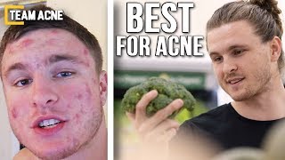 Three Best & Worst Foods for Acne (FROM EXPERIENCE)