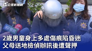 2歲男童身上多處傷痕陷昏迷 父母送地檢偵辦訊後遭聲押｜20250220 公視晚間新聞