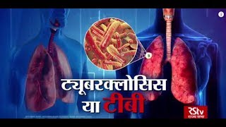 Ayushman Bhava : Tuberculosis (TB) | तपेदिक