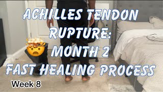 Achilles Tendon Rupture | Month 2 | How I made my tendon heal fast