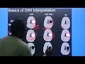 mri diffusion sequences pathology