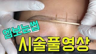 엠보눈썹 시술풀영상