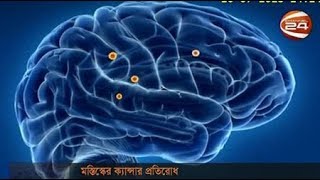 মস্তিষ্কের ক্যান্সারে কাজ করবে মডিফাইড পোলিও ভ্যাকসিন - CHANNEL 24 YOUTUBE