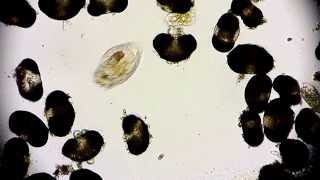 Wimpertierchen - Ciliophora - Ciliata - Ciliate - microorganisms under microscope