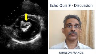 Echo Quiz 9 - Discussion