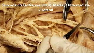 STERNOMASTOID Fascia Neck Regions Cervical Plexus Neurological Clinical Aspects – Sanjoy Sanyal