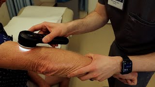 Mayo Clinic Minute - Who should be screened for skin cancer?