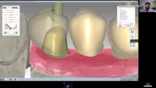 WEBINAR CAD-CAM (August 2012)