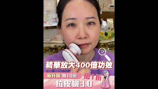 韓國 Deepn 拉皮機｜第三代 ::  1｜ tale beauty | WhatsApp落單👉👉Tel : 53346984