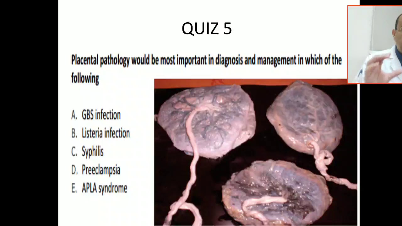 Case 6 How Can Placental Examination Help You For Diagnosis And ...