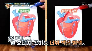 당뇨가 여름철에 더욱 위험한 이유는? TV CHOSUN 20220626 방송 | [알맹이] 183회 | TV조선