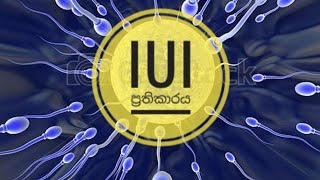 මදසරුභාවයට IUI ප්‍රතිකාරය|Intrauterine Insemination|Mr MLT|2021