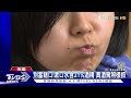 沒喝酒啦 漱口水酒測超標 駕駛獲判無罪｜tvbs新聞 @tvbsnews01