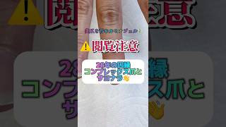 【シン・深爪大変身2💅】28年間のコンプレックスとサヨナラ👋【ルミナジェル】 美爪を育む #深爪 #爪毟り症