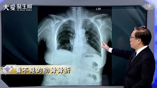 【大愛醫生館】看不見的肋骨骨折 20230627