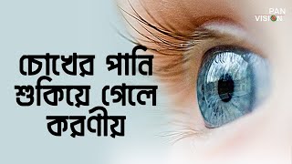 চোখের পানি শুকিয়ে গেলে করণীয় | Dry Eye | Health Tips