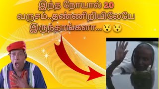 ஒரு நோயால் 20 வருசமா தண்ணீர்லேயே வாழ்ந்தார்களா 🤔🤔/@Voice About Mani #Shorts