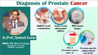 Prostate Cancer Diagnosis and Treatment प्रोस्टेट कैंसर का उपचार  Dr.(Prof)Santosh Kumar PGI