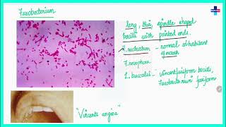 Non sporing anaerobic bacteria ll Free Microbiology Chapterwise lectures ll