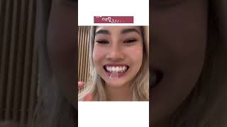 Lineeteeth - วิธีการใช้ เซ็ตทดลองฟอกฟันขาวลินี #lineeteeth #ฟอกฟันขาว