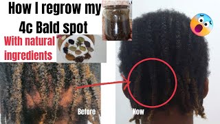 THE MOST POTENT HAIRGROWTH OIL😱|4C NATURAL HAIR|HAIRLOSS TREATMENT