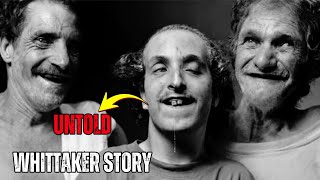The Real Reason Why the Whittakers Are the Most Inbred Family in America