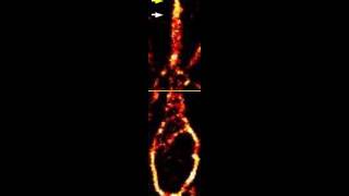 Neuronal migration: Actin contractions in the leading process.