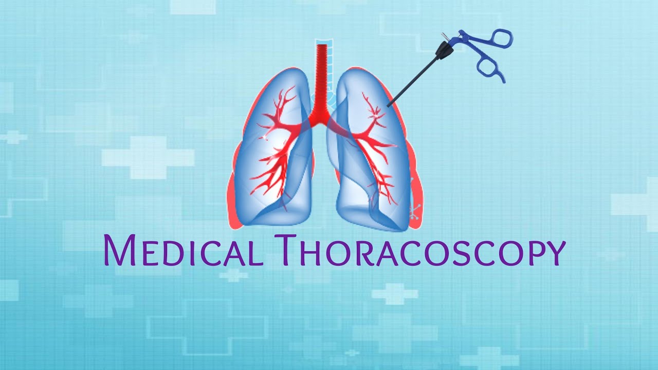 Medical Thoracoscopy - YouTube