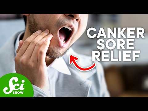How Do You Get Rid of a Canker Sore? How Do You Get Rid of a Canker Sore?