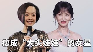 瘦成“大头娃娃”的女星，鲁豫脸颊凹陷，赵雅芝白娘子变白骨精