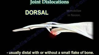 Dislocations Of The Finger - Everything You Need To Know - Dr. Nabil Ebraheim