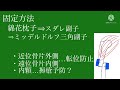 第30回柔道整復師国家試験必修、上腕骨骨幹部三角筋付着部より遠位での骨折の固定