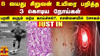 #JUSTIN || 8 வயது சிறுவன் உயிரை பறித்த 3 கொடிய நோய்கள்-பரவி வரும் மர்ம காய்ச்சல்.. சென்னையில் சோகம்