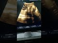 Ultrasound performed by my sister