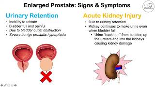Uncovering the Scary Truth Behind Prostate Enlargement Symptoms - You Won't Believe What Causes It!