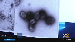 Top monkeypox expert doesn't expect outbreak to become pandemic