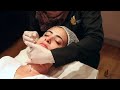 aquagold facial