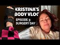 Fitness Vlog: 2 Days After Foot Surgery