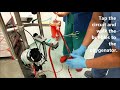 ECMO Troubleshooting: Air Embolism