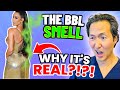 Plastic Surgeon Reacts to the BBL SMELL: Why BBL's Stink!